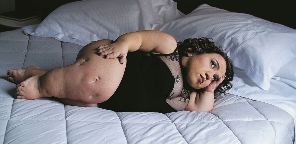 «La sedia a rotelle non toglie la femminilità»