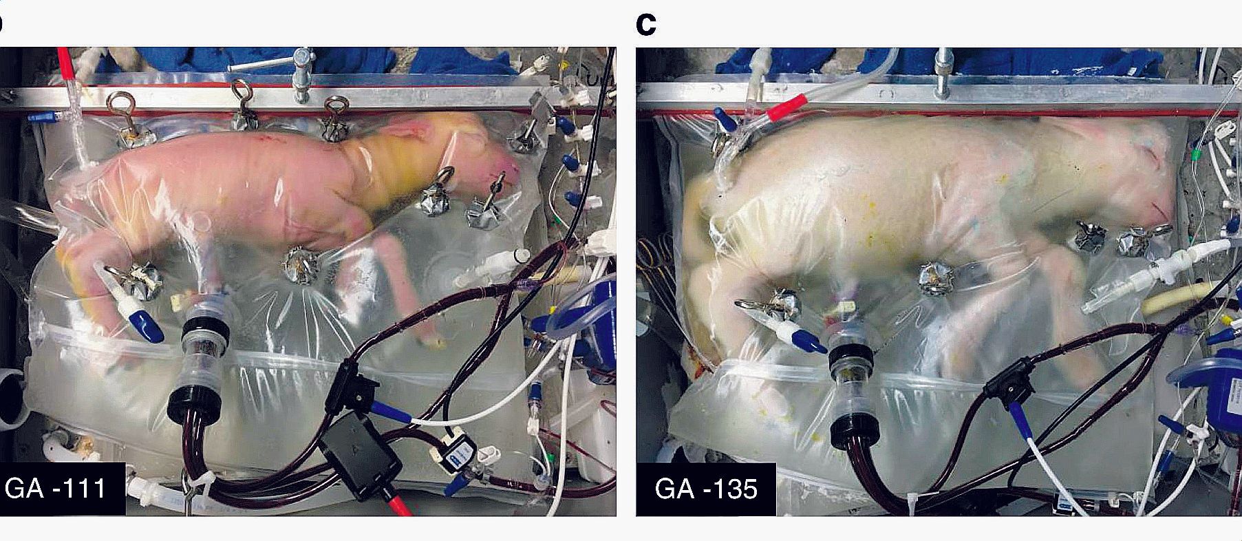 Vogliono eliminare anche le mamme. I figli nasceranno da buste di plastica