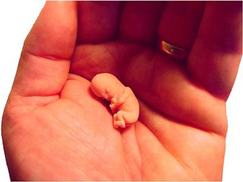 Make America Great Again: Introducing The Oscars, But For Abortions!