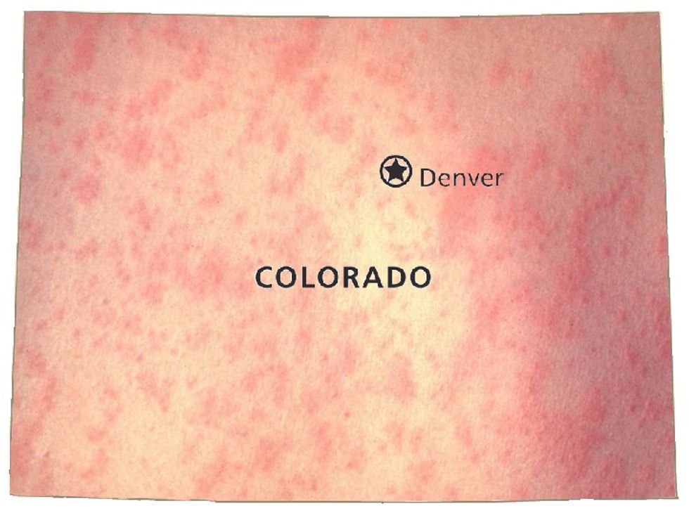 Colorado Wants To Make It Easier For Kids To Spread Disease, Because America