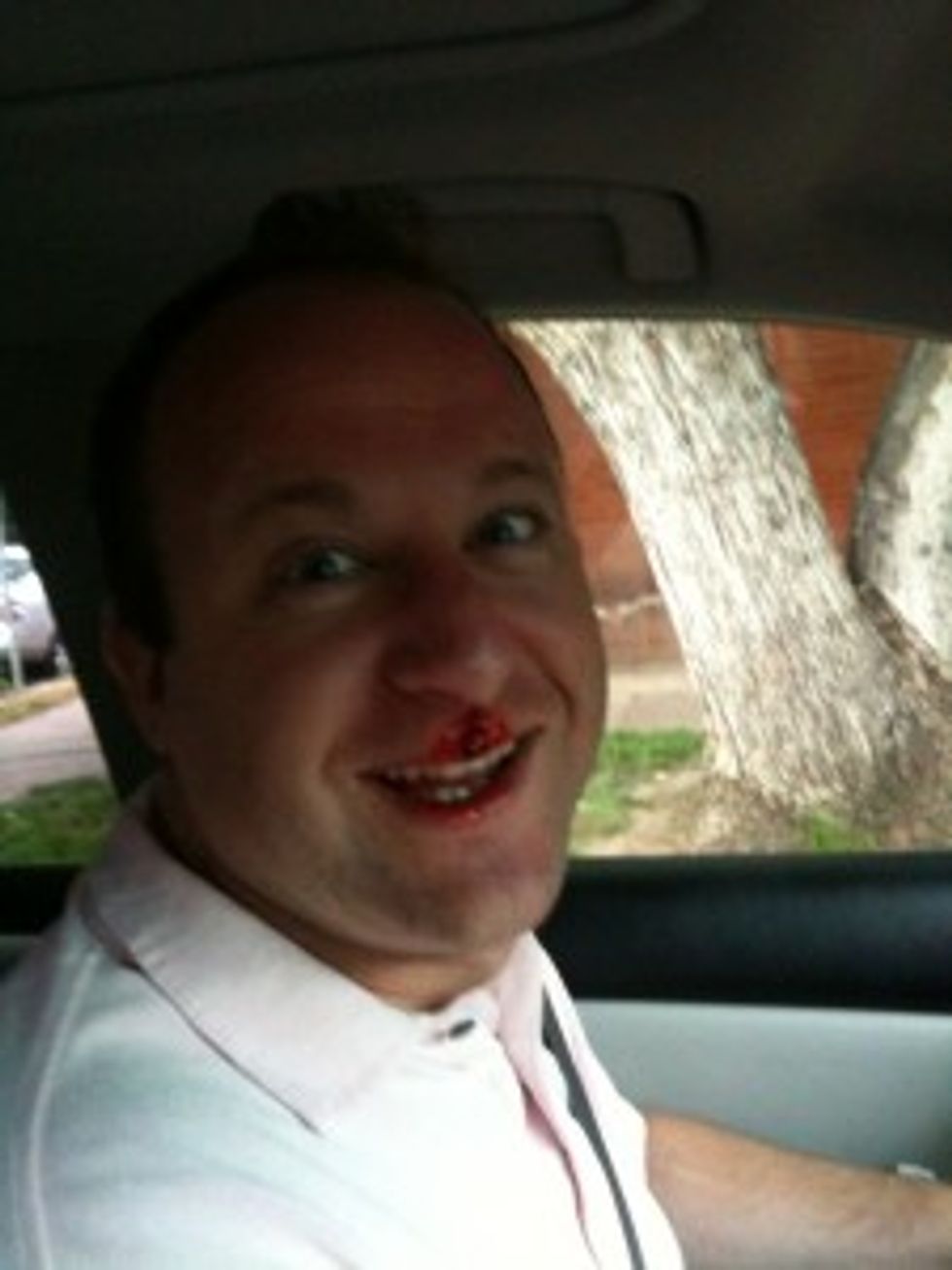 Why Is This Congressman Twittering Scary Bloody-Nose Pictures?