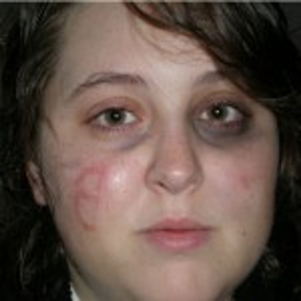 GOP Gal Claims Savage Negro Mugged Her ... For Obama!