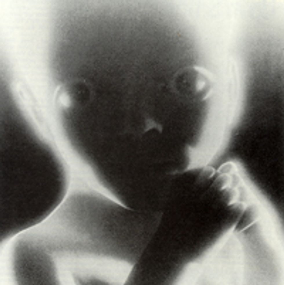 National Review: Doesn't Fancy Obama Know That HE Could've Been Aborted?