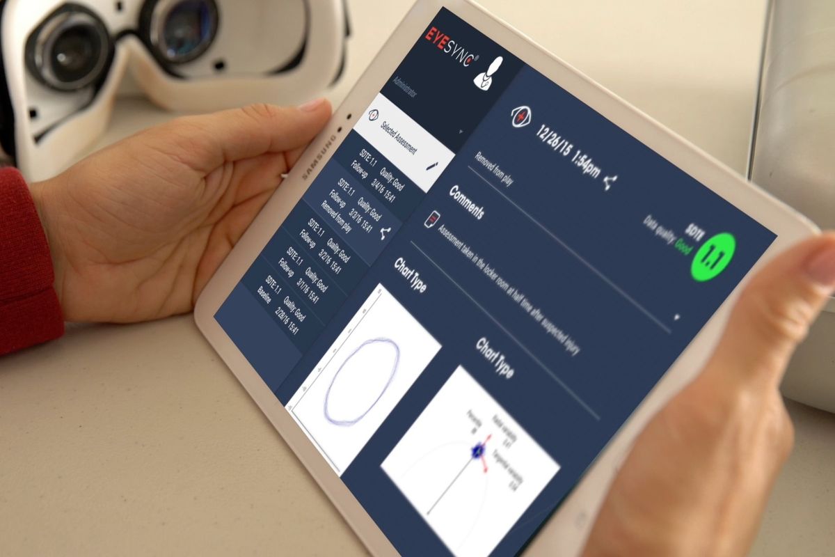 SyncThink Eye-Sync concussion tracking device