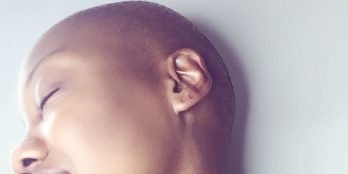 Basking In My Baldness: How I Discovered Self-Love After Hair Loss