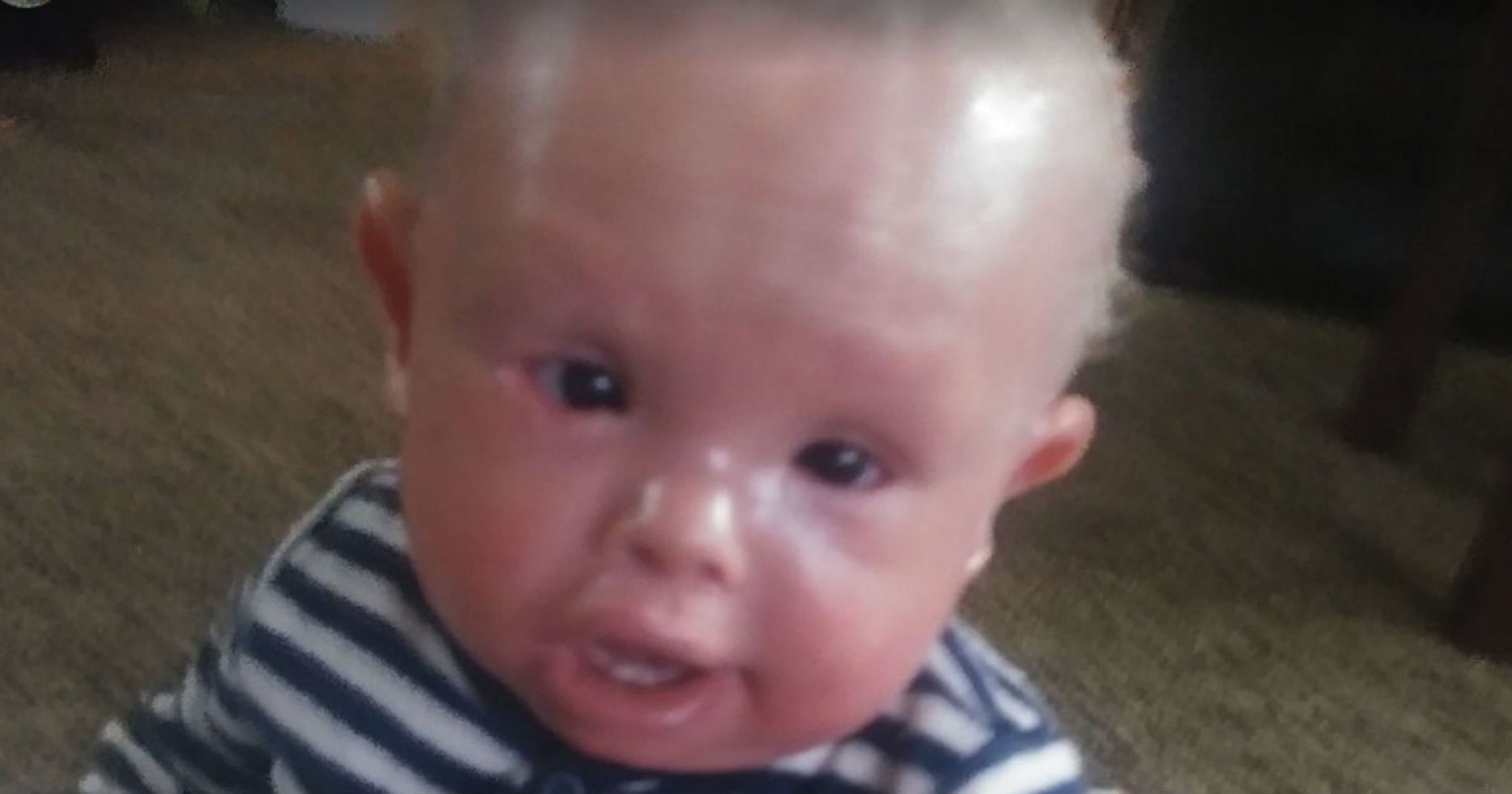 This 1-Year-Old Baby Has To Take Baths With Bleach To Survive Rare Skin Disorder