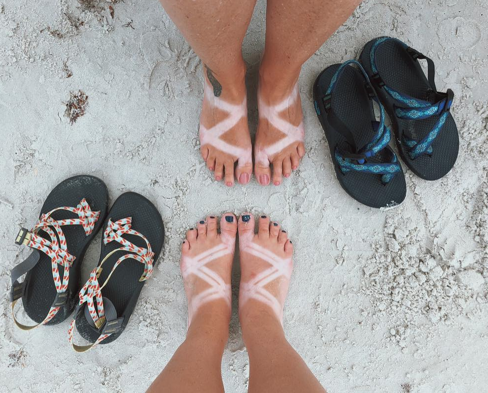 are chacos good for morton's neuroma