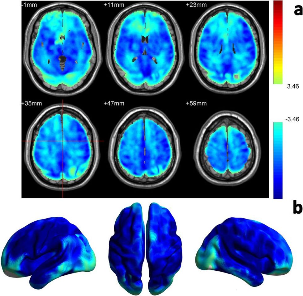 How caffeine works: Less blood flow, brain higher entropy - Big Think