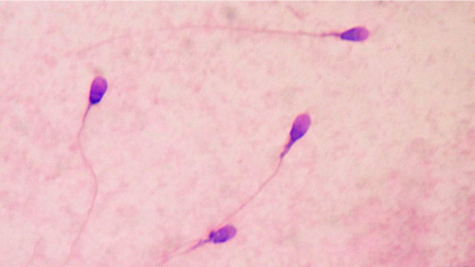 lonely sperm