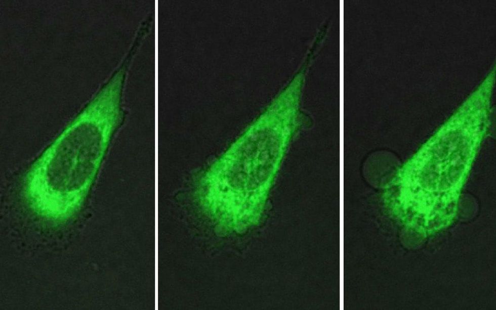 Last photo shows blebbling or bubbling of the cytoplasm leaking out of the cancer cell.