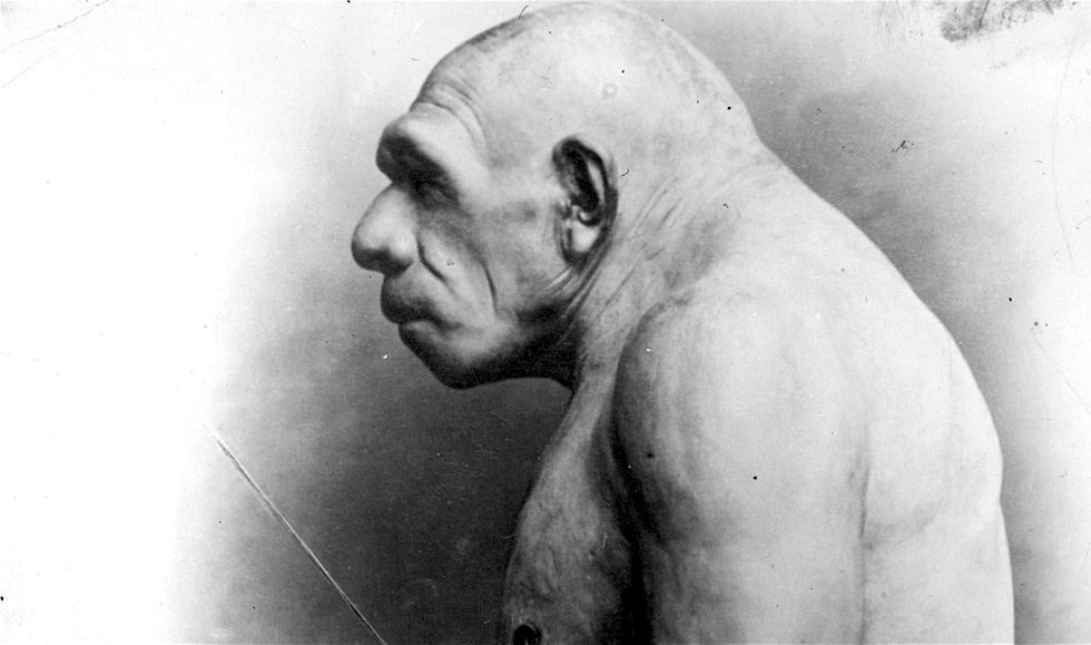 Neanderthal man