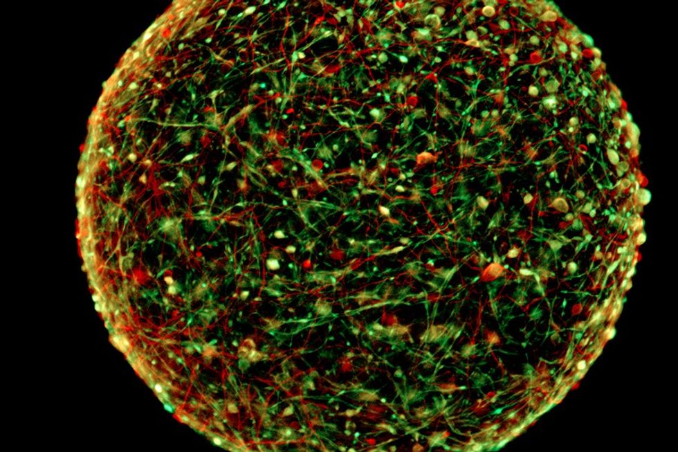 Mini-brain or neural organoid.