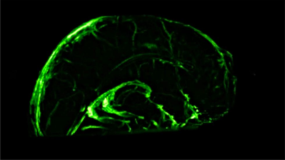 lymphatic system in the dura mater