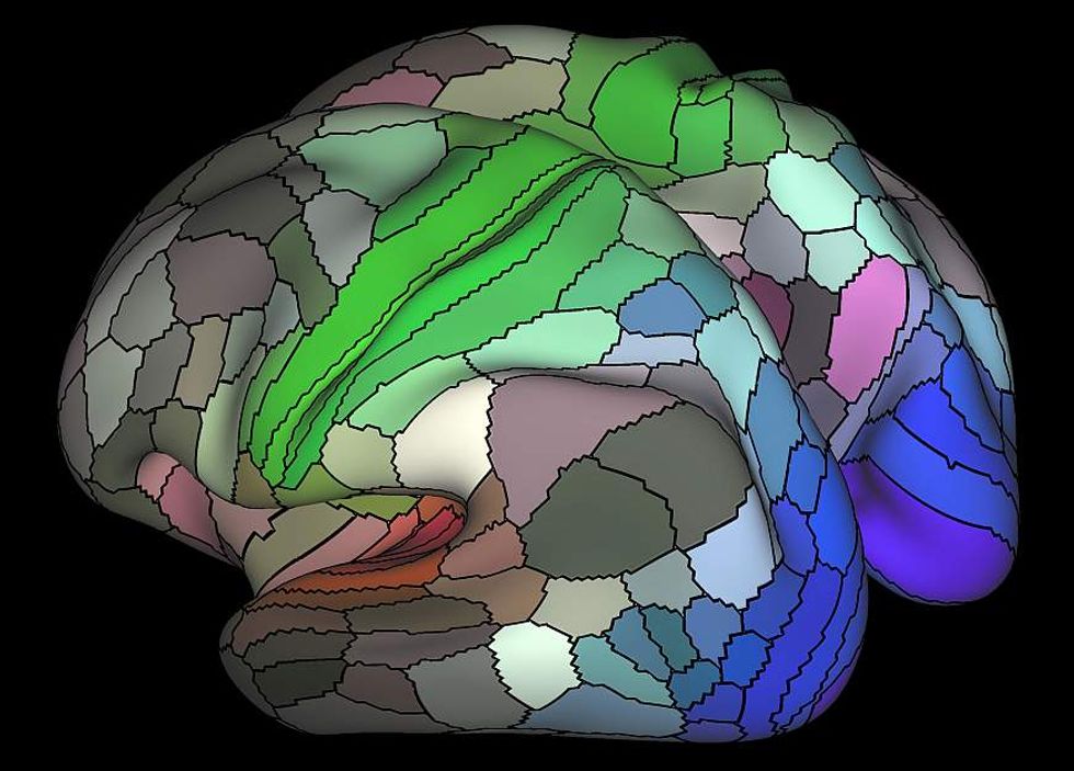 fMRI scan.
