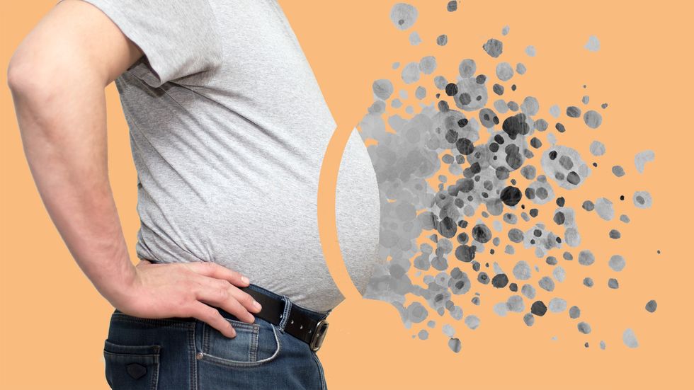 Fat dissolving from a large man's stomach.