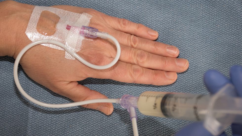 Anesthetic Propofol works by inhibiting neural connections Big Think