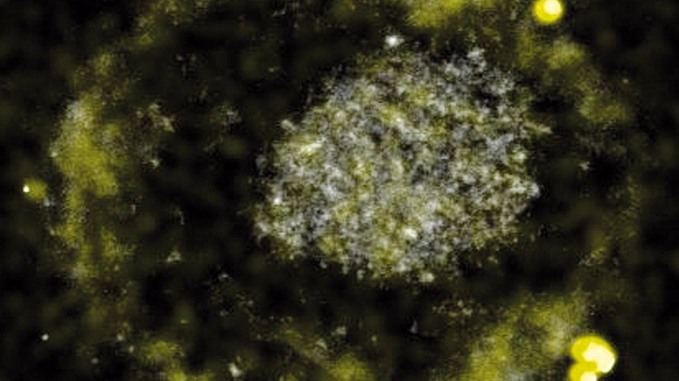This bacteria literally poops gold