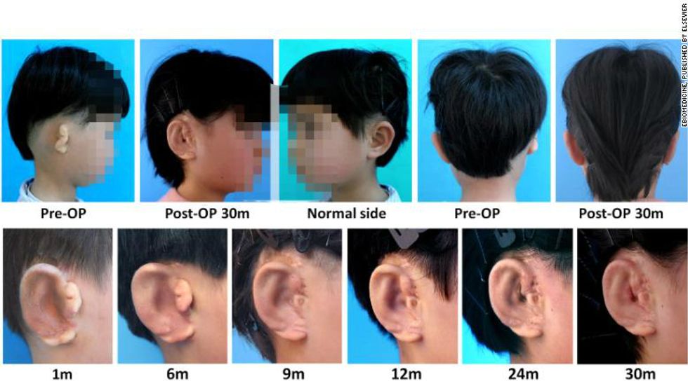 Photo from study, patient's face blurred to protect identity