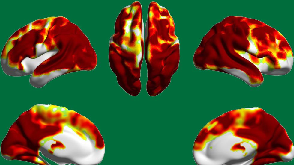 Caffeine-induced resting brain entropy increase in a large portion of the cerebral cortex. (Scientific Reports ISSN 2045-2322)