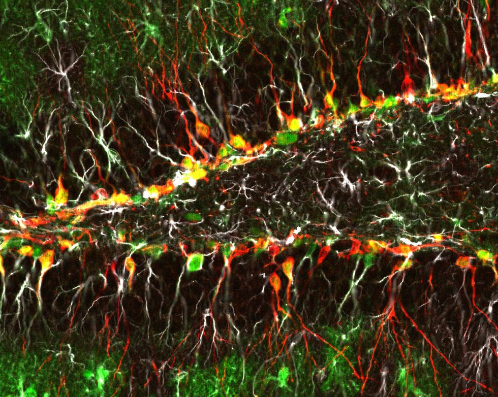 Active neurons in the brain.