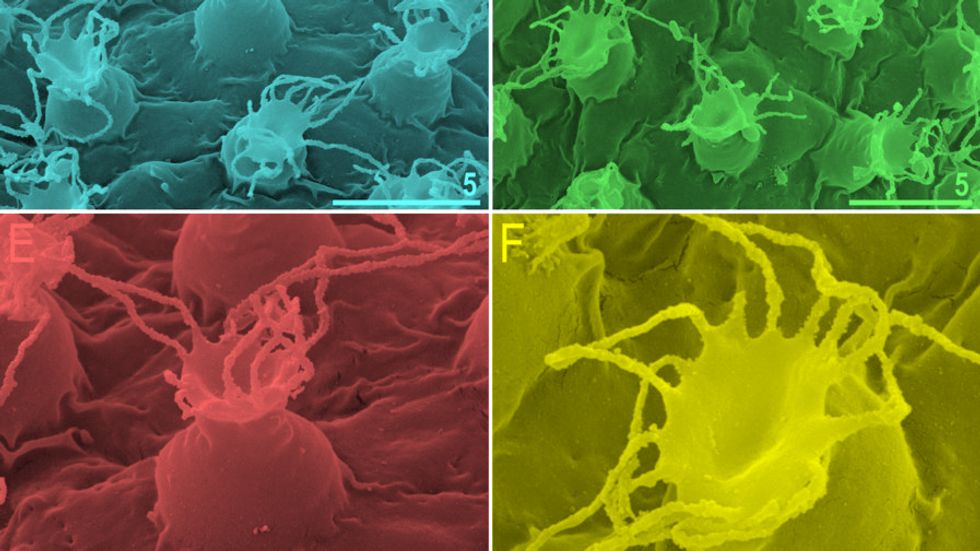 Macrobiotus shonaicus sp. nov.–egg chorion morphology seen in SEM. A–B–entire eggs with clearly visible flexible filaments on the egg processes; C–D–processes with filaments of various lengths and the surface between processes; Credit: http://bit.ly/2oLzJ