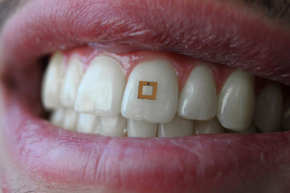 Tufts University scientists have created a tooth-mounted sensor.