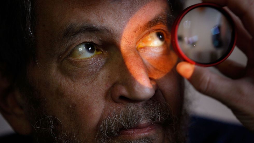 William Weiser has his eyes examined at the Central Blind Rehabilitation Center at the Edward Hines Jr. VA Hospital November 5, 2009 in Hines, Illinois. The Blind Rehabilitation Center offers various programs to help blind veteran