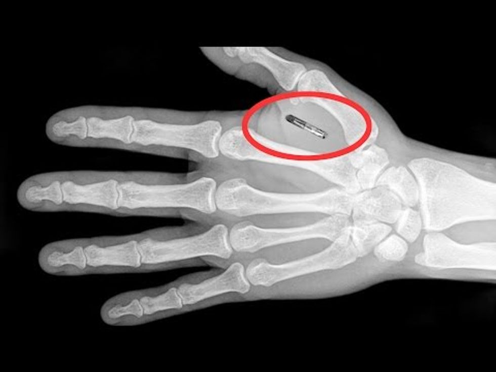 Turning Cyborg. You May be Microchipped in the Future.