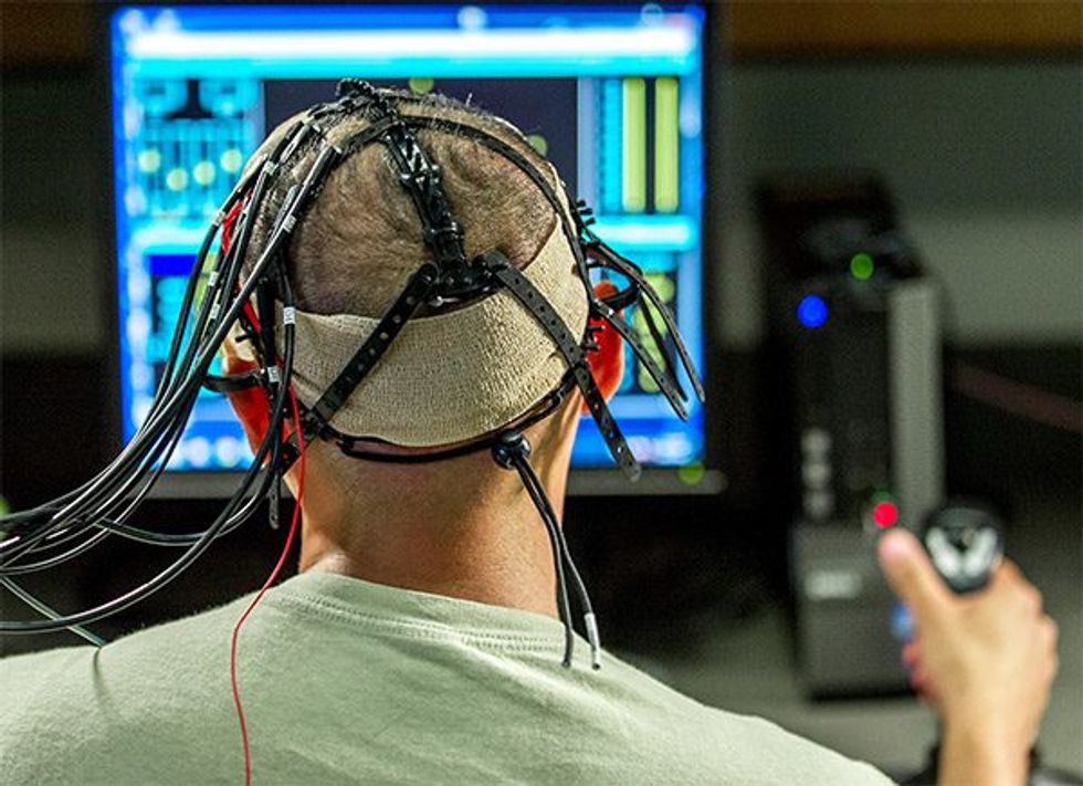 One Key Finding Has Put Brain Stimulation Devices Back on the Cards ...