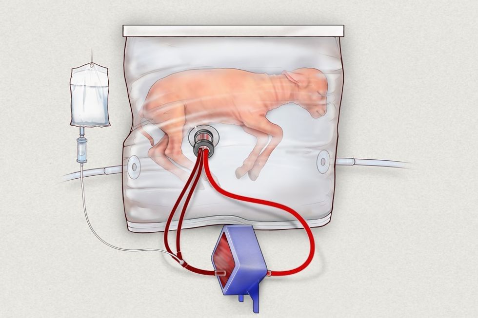 lamb fetus in a BioBag