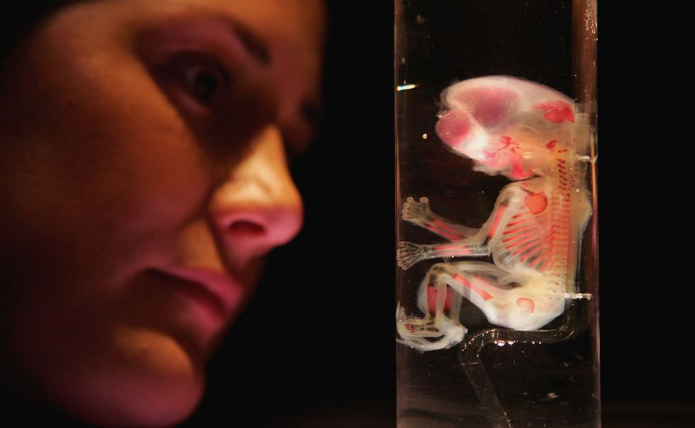 Artificial Womb Technology: Who Benefits?