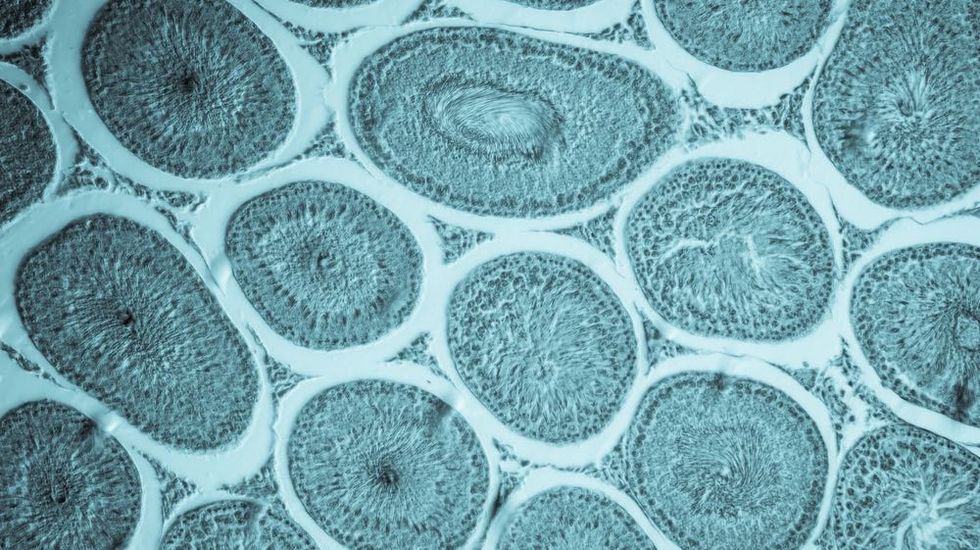 New Protein Supercharges Immune System to Fight Cancer