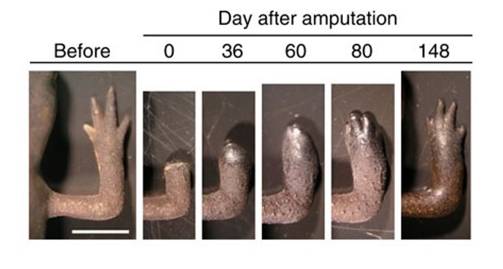 We’re One Step Closer to Making Limb Regeneration a Reality
