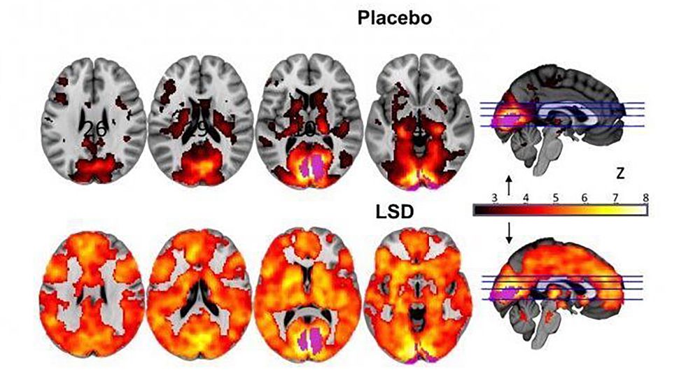 Study Shows How LSD Mimics Infant's Mind as Ego Dissolves