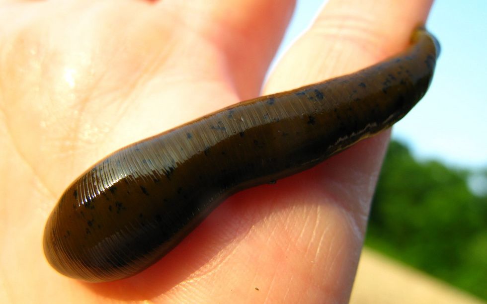 A leech crawling on a human hand.
