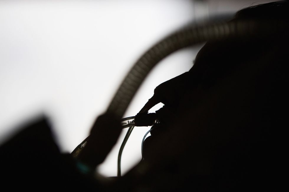 What Brain Death Is and Why It Matters