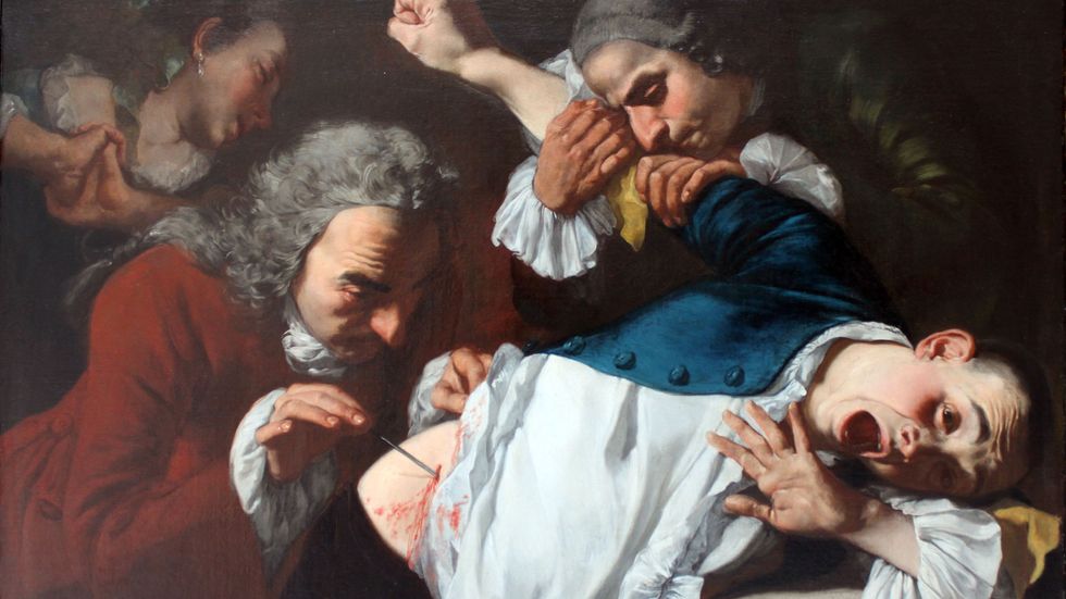 Surgery, old-school