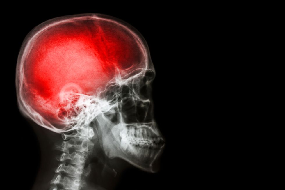 Human brain scan.