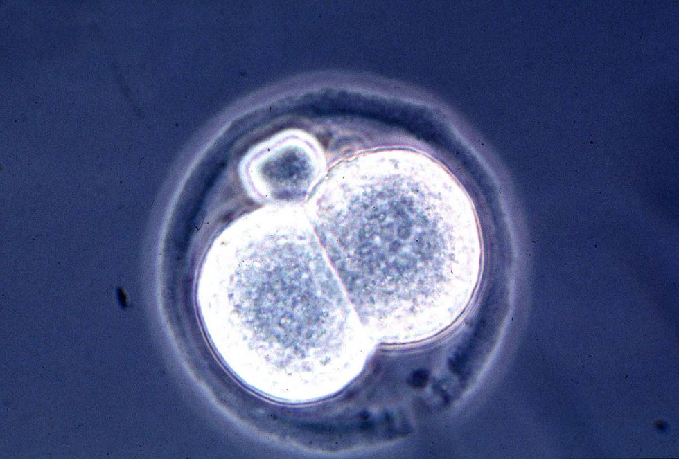 Cloned embryo.