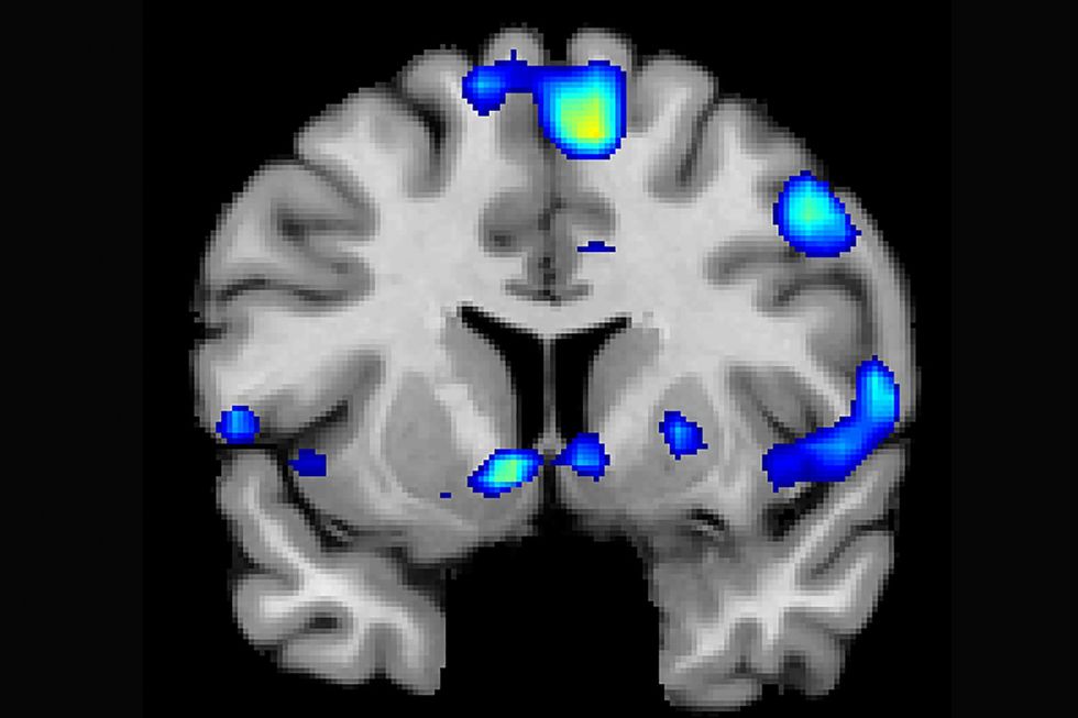 Scientists find religion triggers same area of brain as sex, drugs and love