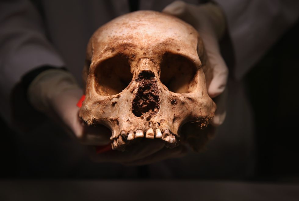 An unearthed skull.
