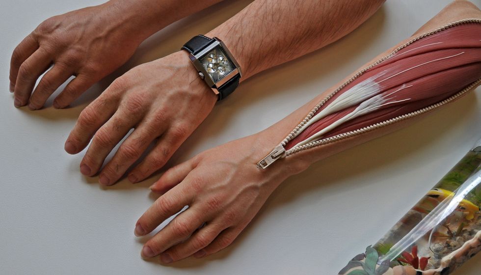 German artificial limb maker.