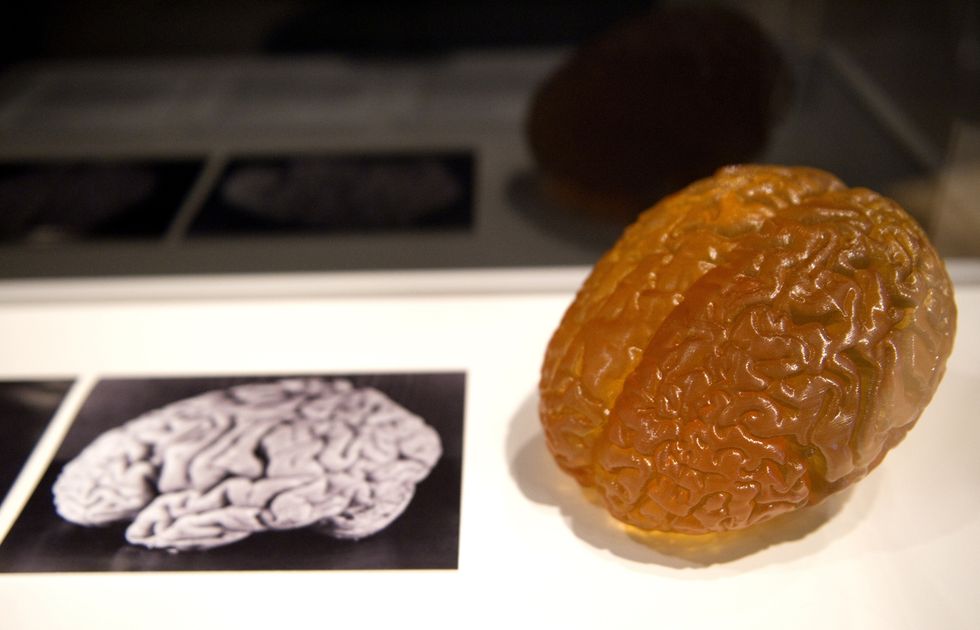 A picture shows a picture and model of Albert Einstein's brain on display during a preview of the Wellcome Collection's major new exhibition 'Brains: mind of matter' in London on March 27, 2012. (MIGUEL MEDINA/AFP/Getty Images)