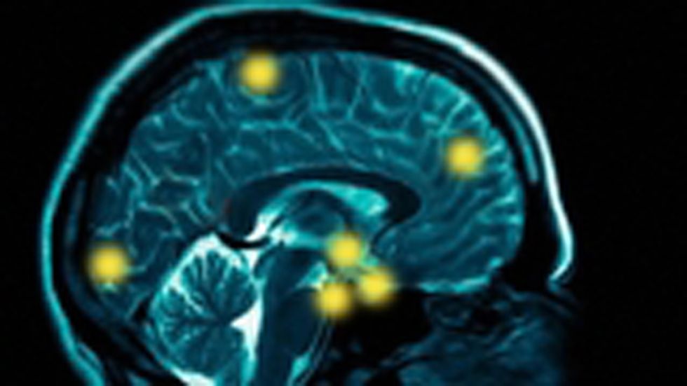 Does the Brain Control the Mind or the Mind Control the Brain?