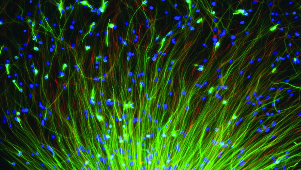 Wiring the Brain: How Viruses Can Be Engineered to Trace Neural Connections