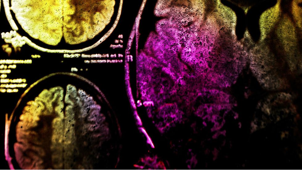 This Is Your Brain During Orgasm