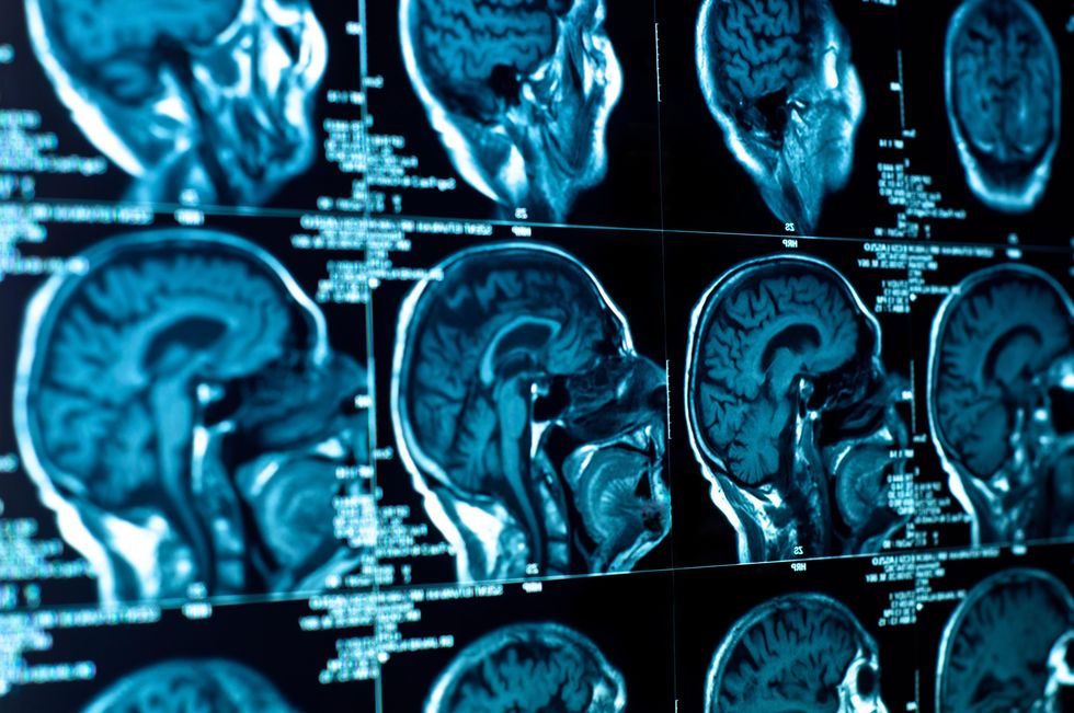 Subconscious Brain Processes Improve Decision Making