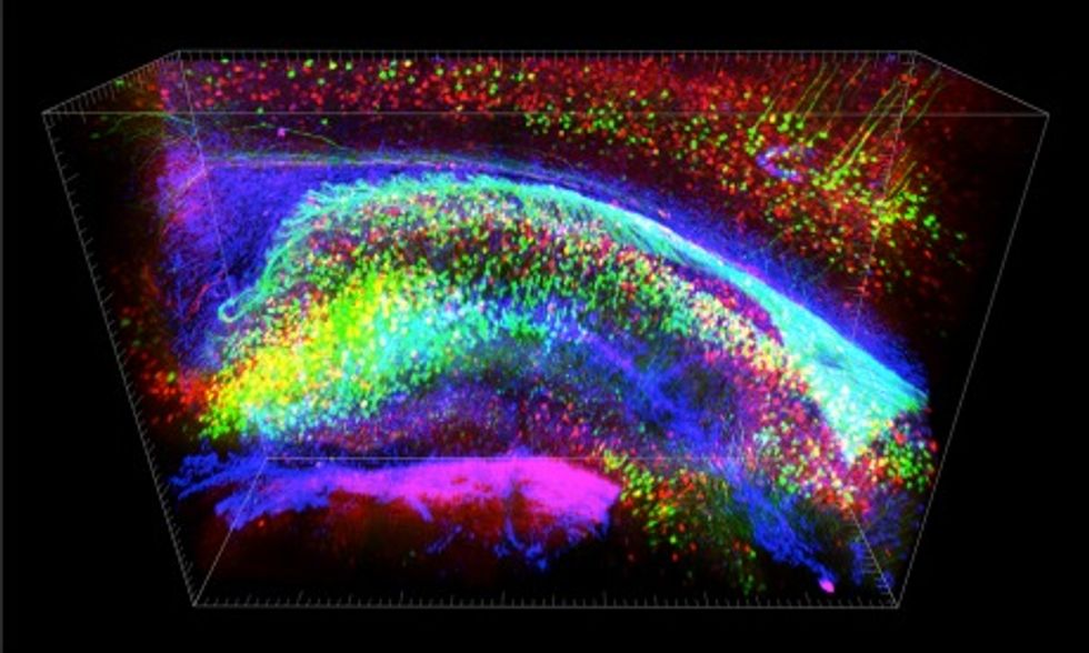 Transparent Brain Imaging Will Accelerate Research 10 to 100 Times