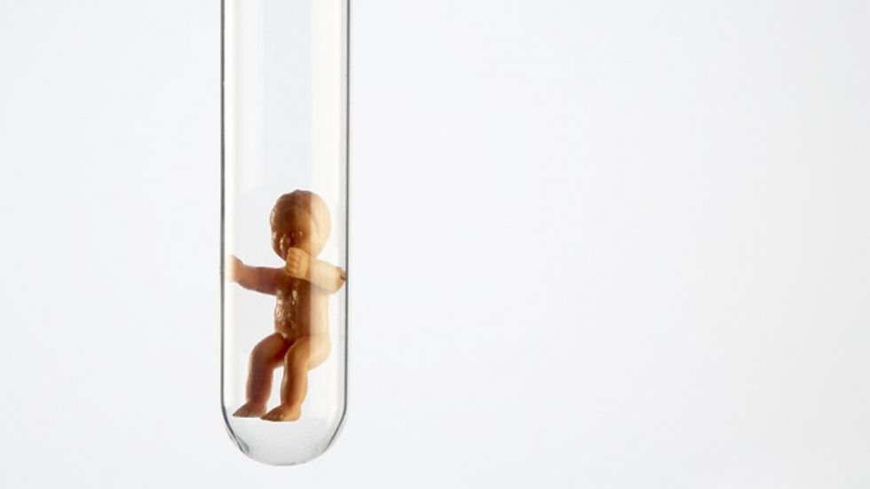 A Simpler, More Affordable Method Of IVF