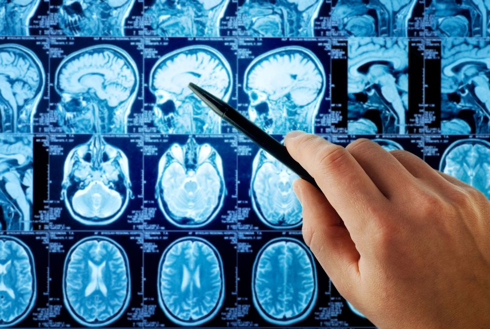 Two Ways Neuroscience Will Impact the Law